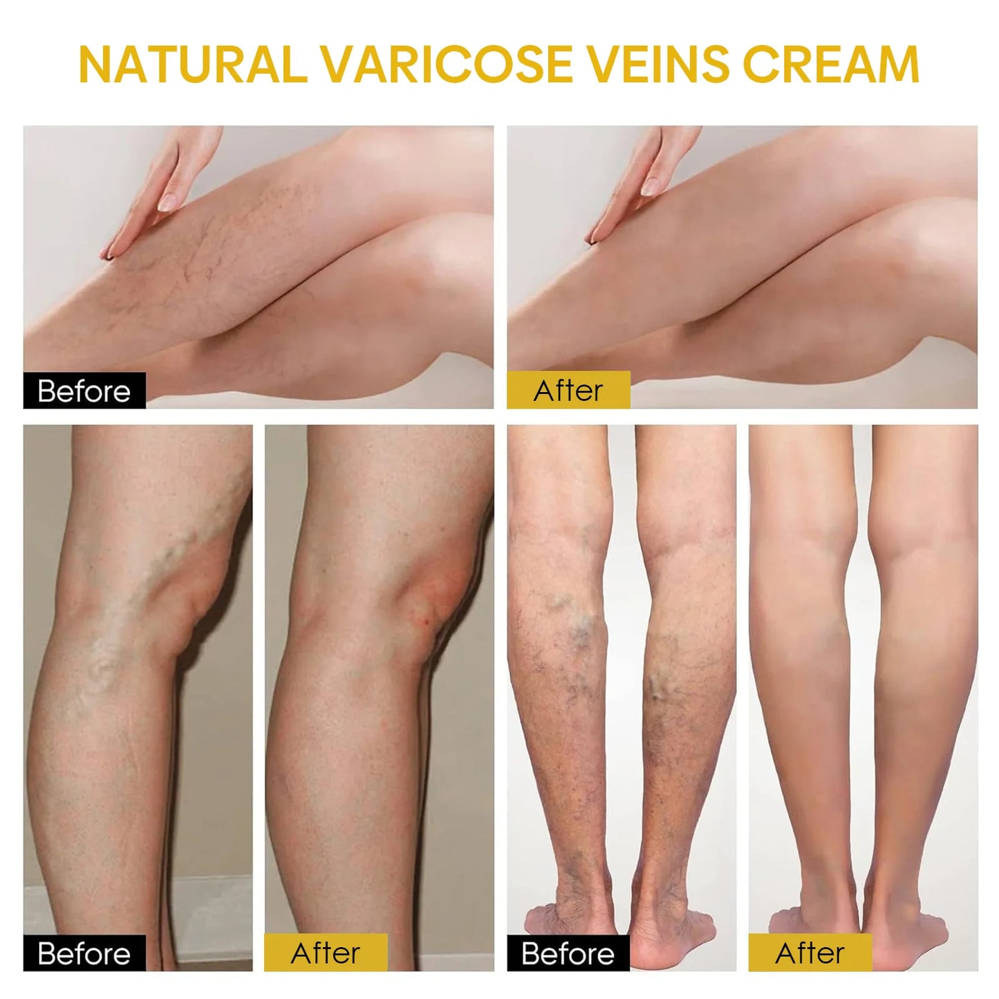 Ximonth Bee Venom Vein Repair Cream 60g