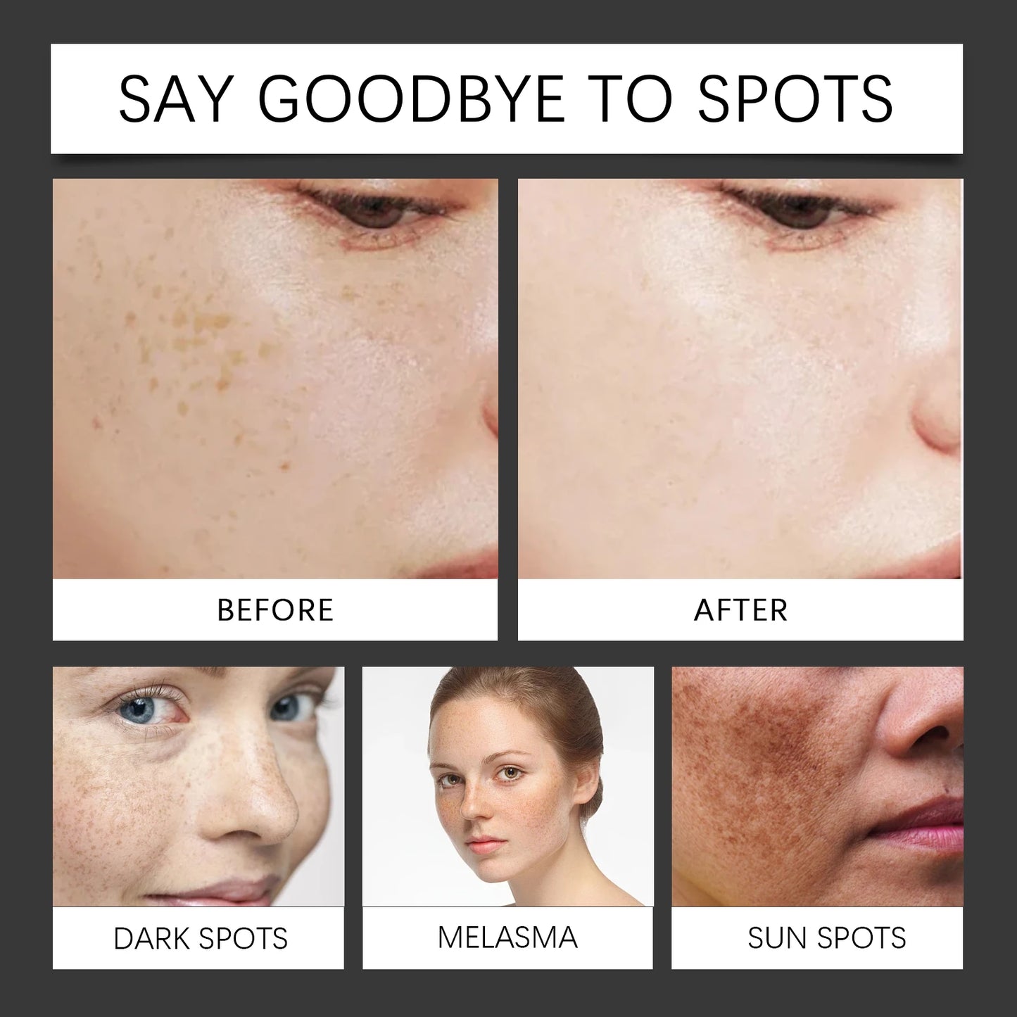 Bee Venom Dark Spot Repair Essence Serum