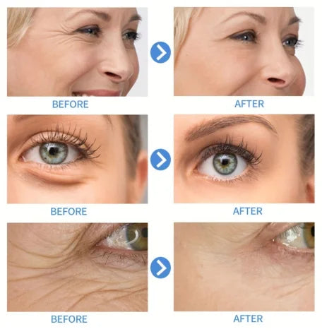 OUHOE Lifting and Brightening Face Serum