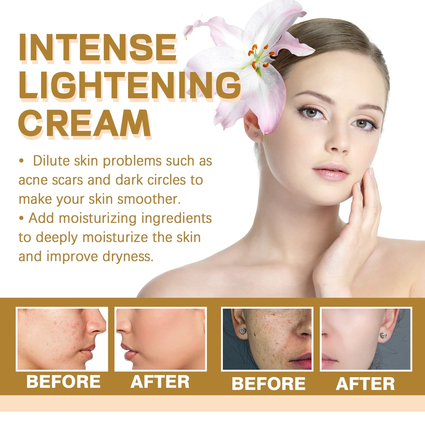 Hoygi Intense Lightening Cream 50g