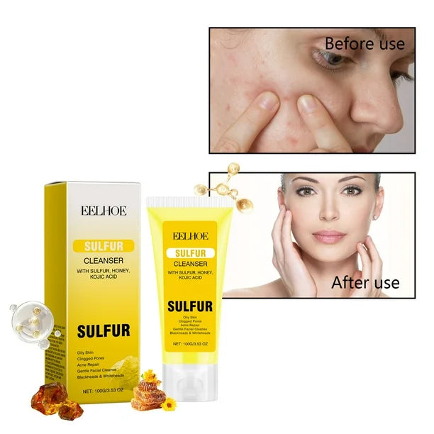 EELHOE Sulfur Acne Repair with Oily Skin 100g