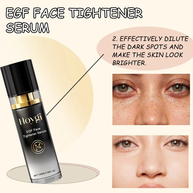 EGF Brightening Face Serum – Dark Spot Fading, Hydrating & Anti-Aging