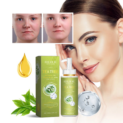 EELHOE Anti-Acne & Moisturizing Liquid – Fades Marks, Tightens Pores, 100ml
