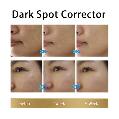 Brightening & Firming Face Cream Dark Spot & Wrinkle Care