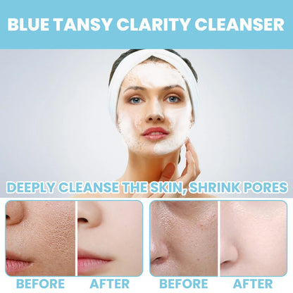 EELHOE Blue Tansy Clarity Cleanser Soothing and Pore Refining Face Wash, 100ml