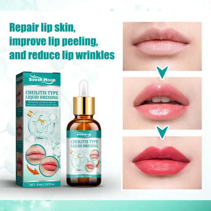 South Moon Cheilitis Relief Lip Serum Soothes, Repairs and Hydrates