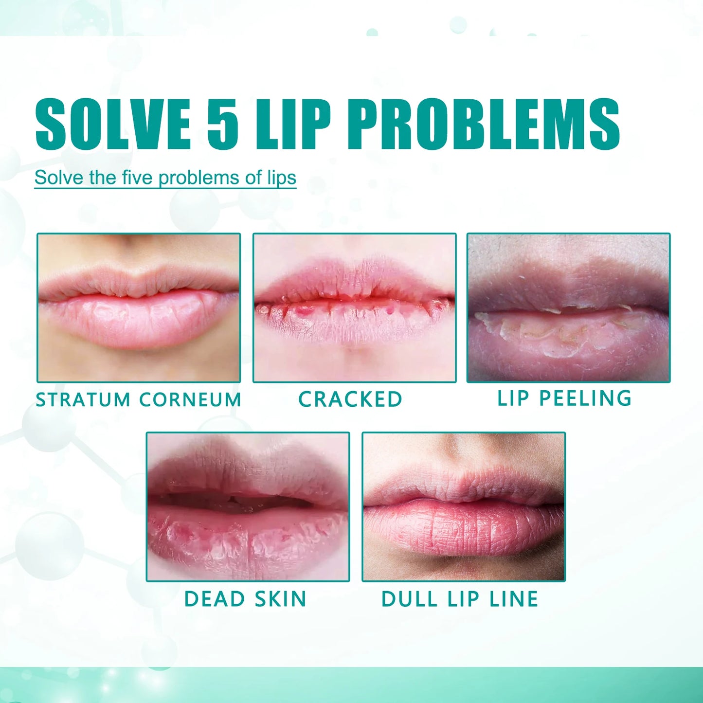 South Moon Cheilitis Relief Lip Serum Soothes, Repairs and Hydrates