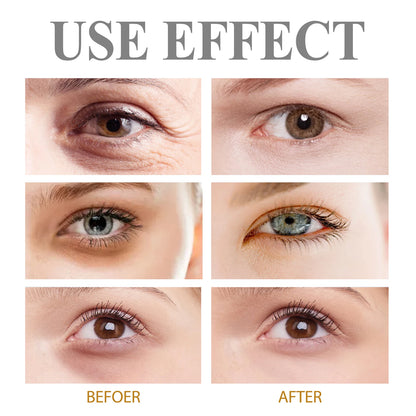 Reduces Fine Lines & Wrinkles Targets early signs aging for the youthful eyes