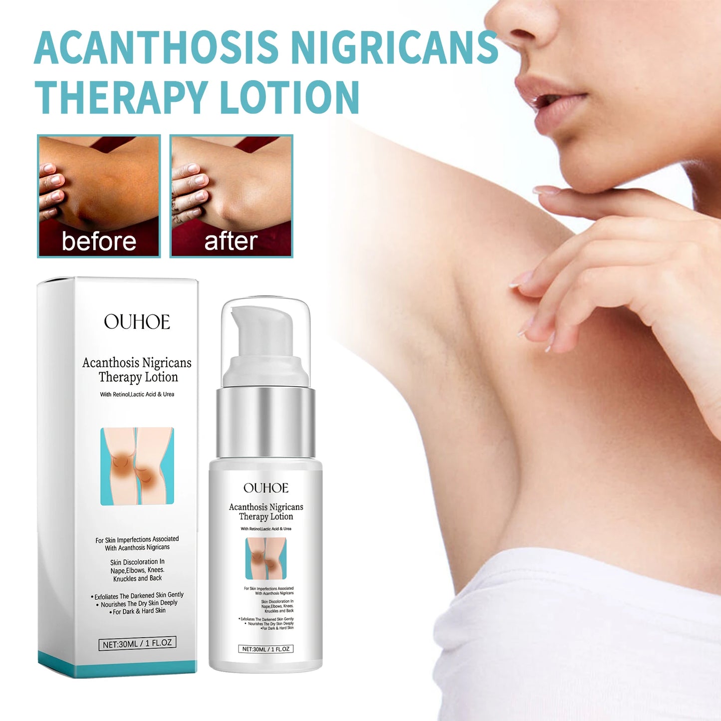 OUHOE Skin Tone Correcting Lotion 30ml