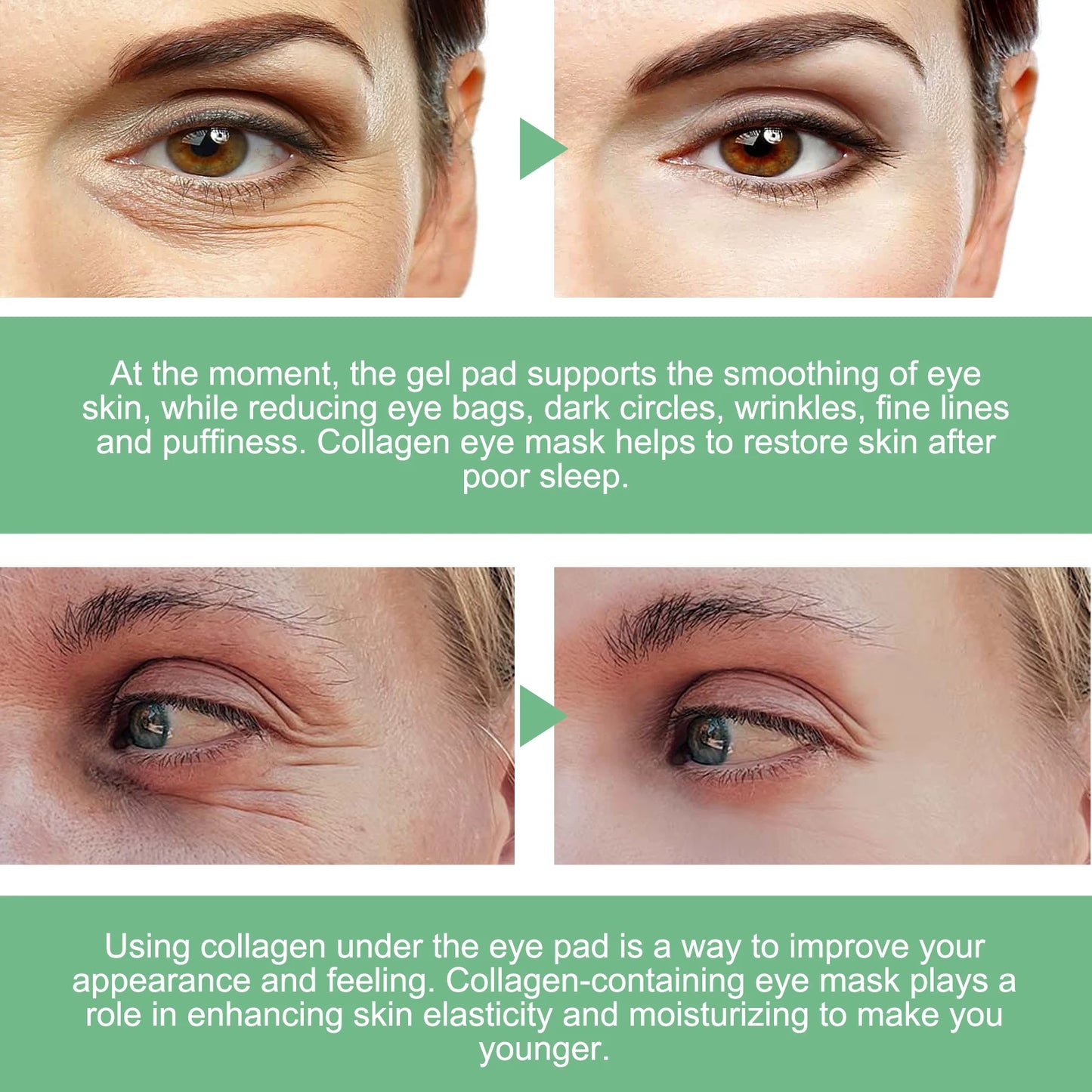 Aloe Vera Under-Eye Patches Reduces Puffiness and Dark Circles, 30 Pairs