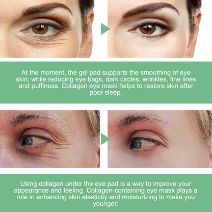 Aloe Vera Under-Eye Patches Reduces Puffiness and Dark Circles, 30 Pairs