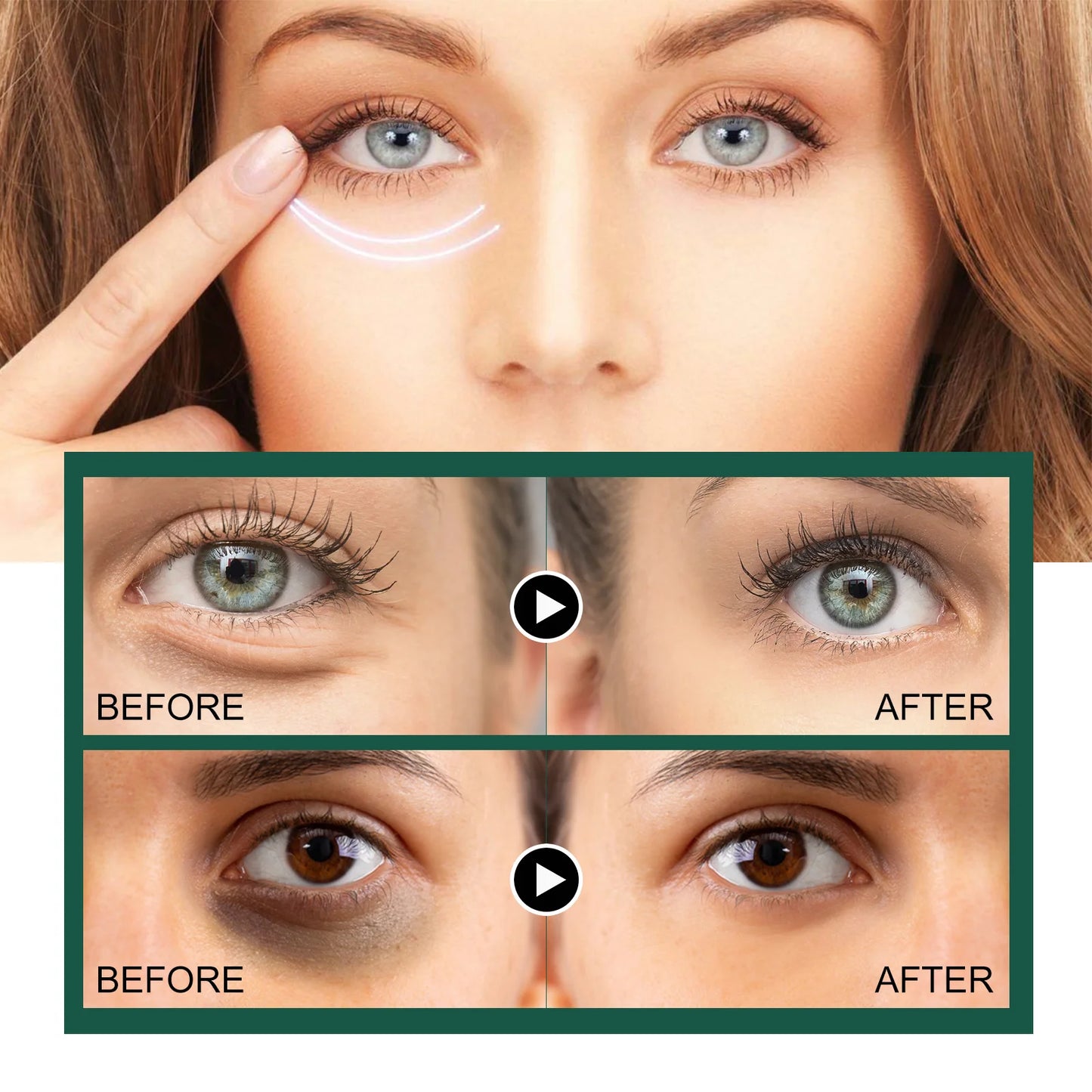 Cordyceps-Infused Formula Nourishes and the revitalizes delicate under-eye skin