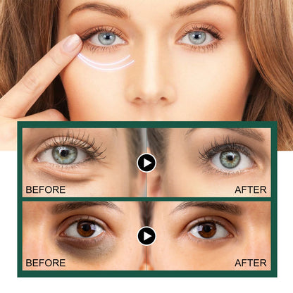 Cordyceps-Infused Formula Nourishes and the revitalizes delicate under-eye skin