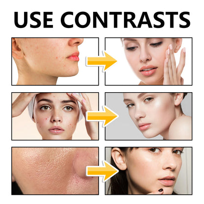 EELHOE Sulfur Acne Repair with Oily Skin 100g