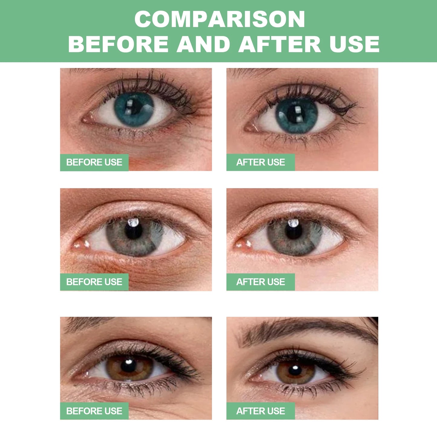 Aloe Vera Under-Eye Patches Reduces Puffiness and Dark Circles, 30 Pairs