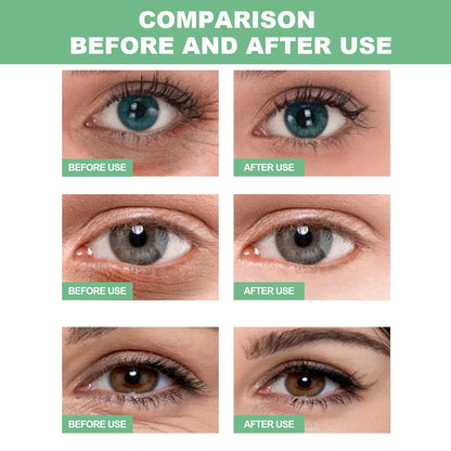 Aloe Vera Under-Eye Patches Reduces Puffiness and Dark Circles, 30 Pairs