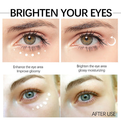 Anti-Aging Eye Cream Reduces Wrinkles, Puffiness & the Dark Circles