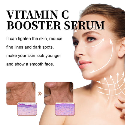 Vitamin C Essence with Niacinamide 30ml with Natural Complete 30X Vitamin C Booster Serum