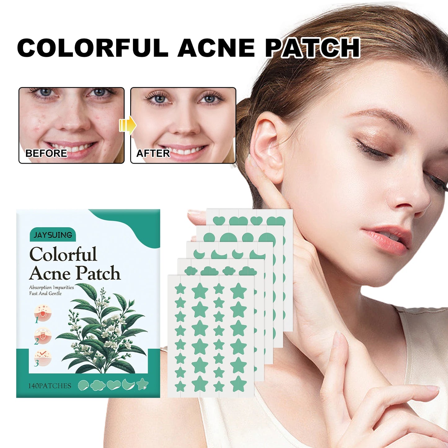 140 Green Acne Patches for Scar Repair
