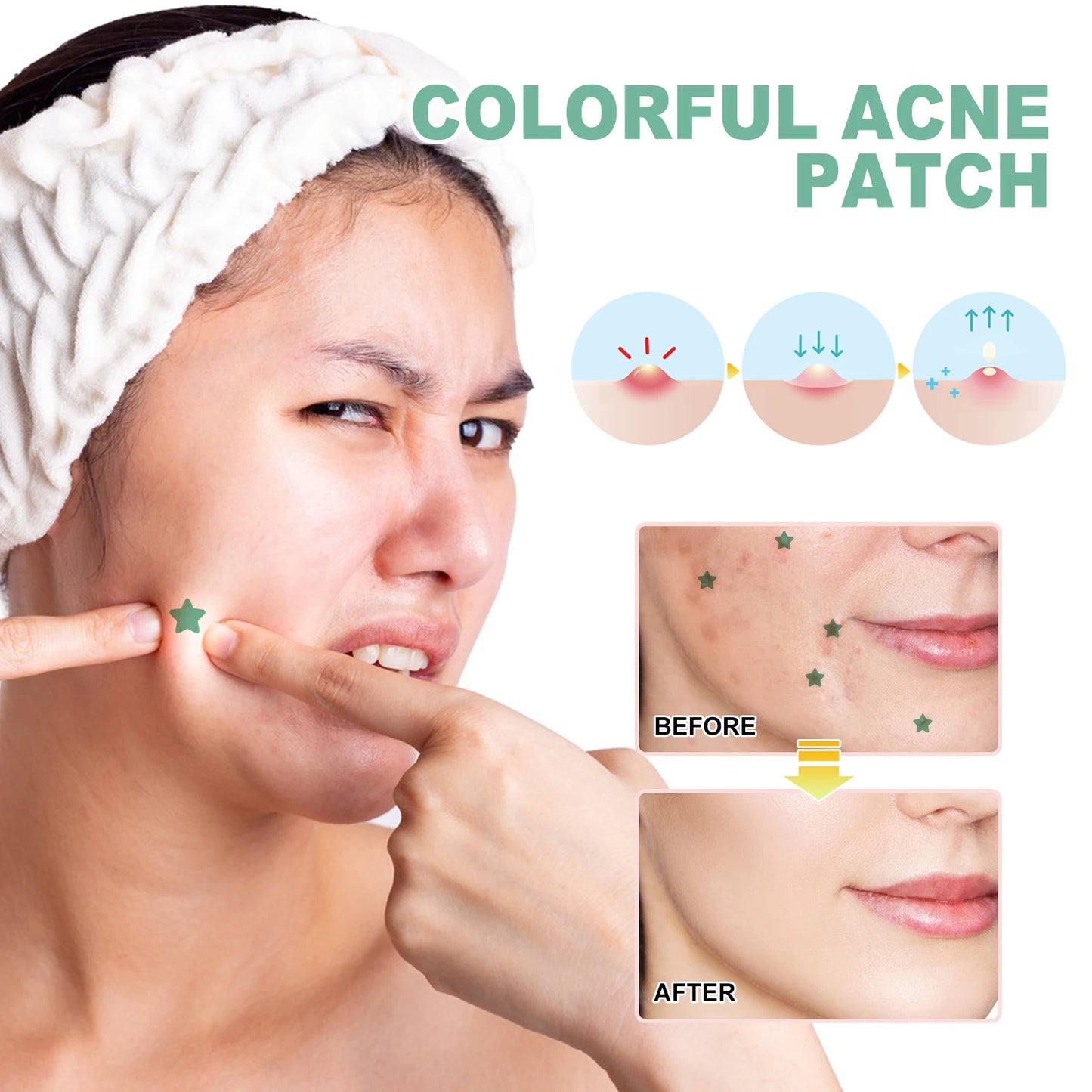 140 Green Acne Patches for Scar Repair
