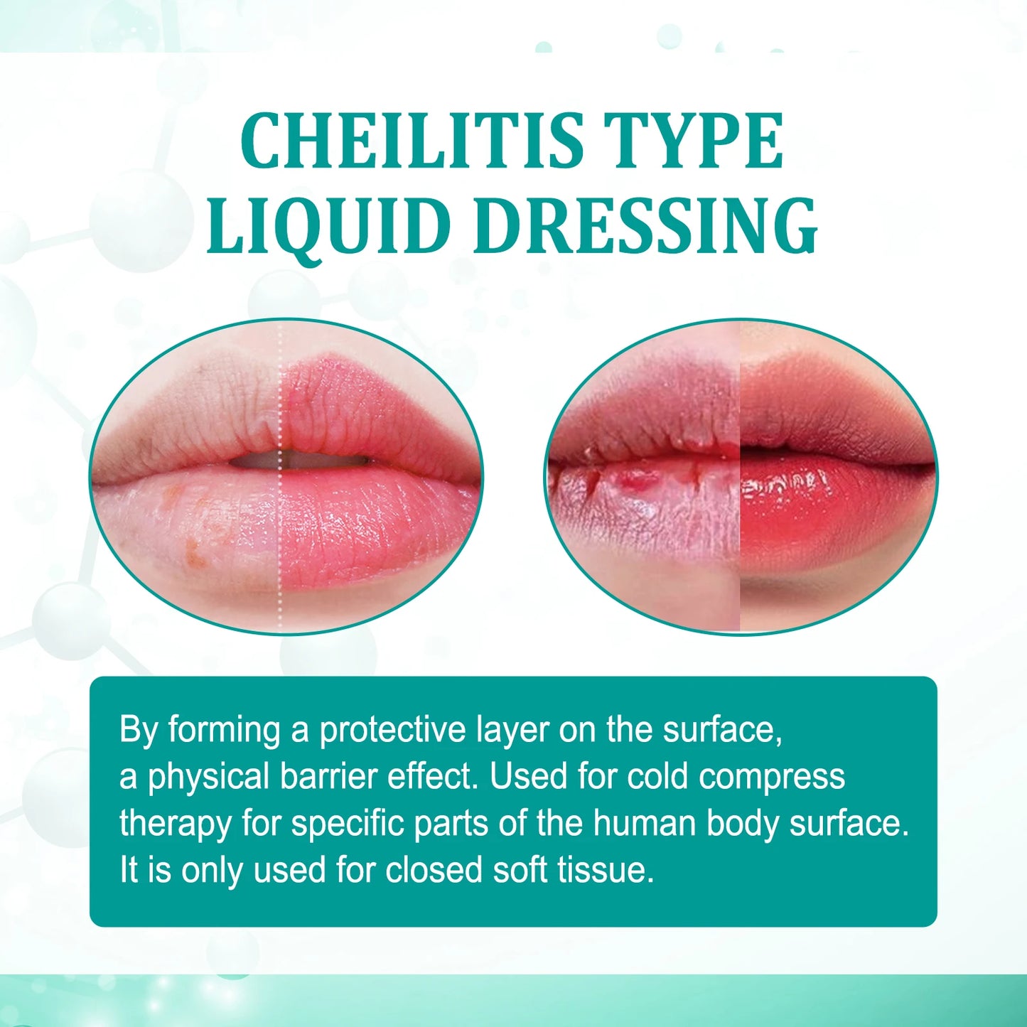 South Moon Cheilitis Relief Lip Serum Soothes, Repairs and Hydrates