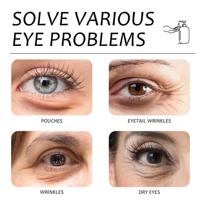 Anti-Aging Eye Cream Reduces Fine Lines, Dark Circles and the Puffiness