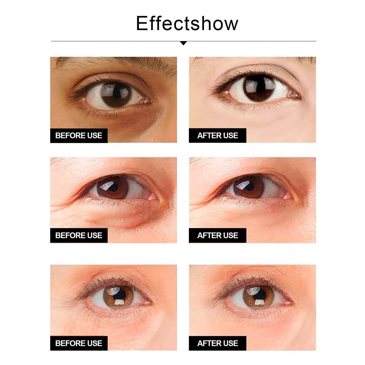 Anti-Aging Eye Cream Reduces Wrinkles, Puffiness & the Dark Circles