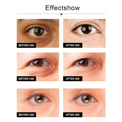 Anti-Aging Eye Cream Reduces Wrinkles, Puffiness & the Dark Circles