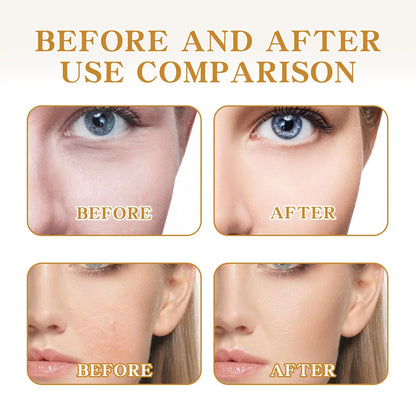 EELHOE Brightening Face Serum B3, Vitamin C, Anti-Aging & Acne Care
