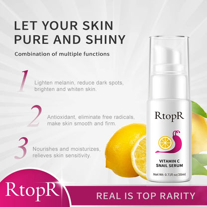 Vitamin C & Snail Serum – Dark Spot Corrector, Skin Repair & Brightening, 30ml