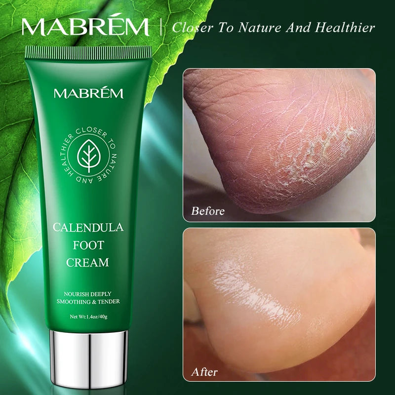 Calendula Foot Scrub, Moisturizer Smooths, Softens and Repairs Heels