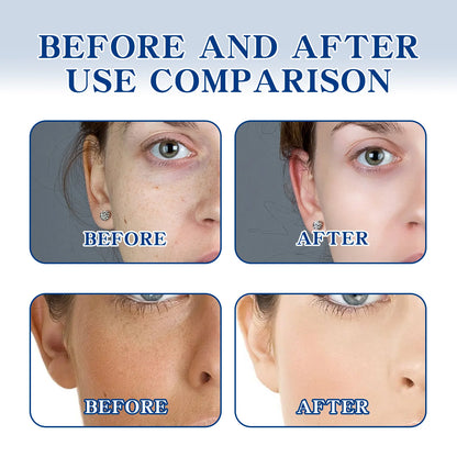 OUHOE Whitening Freckle Essence Cream Brightening, Spot-Reducing and Hydrating, 50g