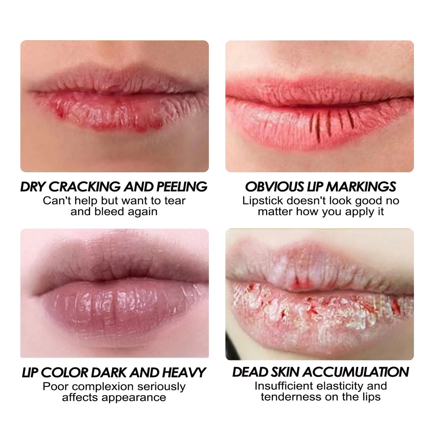 EELHOE Lip Collagen Sleeping Mask Overnight Hydration and Repair