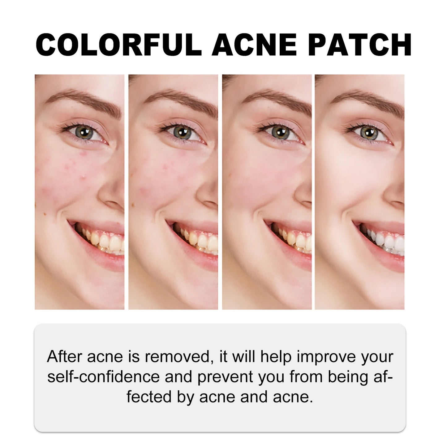 140 Green Acne Patches for Scar Repair