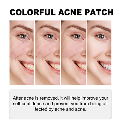140 Green Acne Patches for Scar Repair
