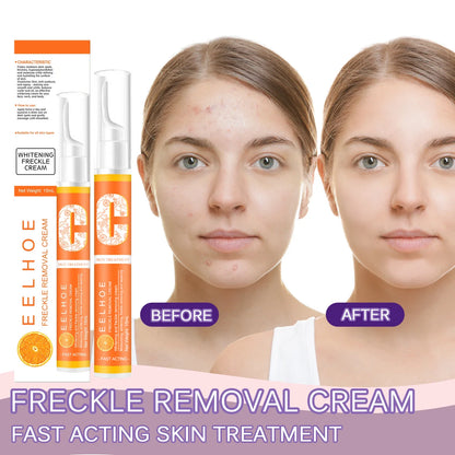 Multi-Action Vitamin C Spot Fading Pen for Women Brightening, Anti-Aging and Acne Care